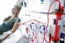 Sự thật về phương pháp “lọc máu” làm đẹp, phòng đột quỵ...