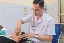 Chữa liệt dây thần kinh số VII ngoại biên bằng y học cổ truyền