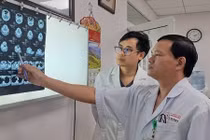 Người đàn ông mắc u thân cảnh hiếm gặp, bác sĩ cảnh báo