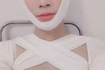 Thực hư "thánh giả gái" BB Trần làm ngực khiến fan sửng sốt