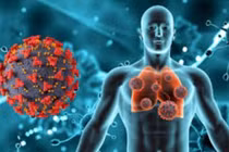 5 hiểu lầm thường gặp trong ung thư phổi