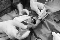 Cứu sống bệnh nhi bị thoát vị hoành bẩm sinh