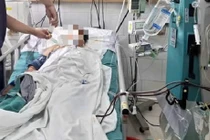 Uống thuốc nam không rõ nguồn gốc, người phụ nữ suy gan cấp