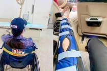 Nhật Kim Anh bị ngã rách dây chằng, nhìn nẹp chân mà xót