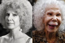 Phát khiếp với 15 "thảm họa dao kéo" khuôn mặt biến dạng