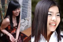 "Soi" nhan sắc Lệ Quyên trước nâng mũi và sau khi tháo sụn