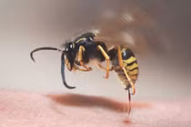 Nam bệnh nhân sốc phản vệ, ngưng tim do ong đốt