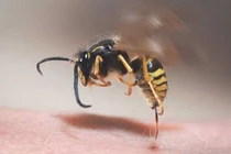 Nam bệnh nhân sốc phản vệ, ngưng tim do ong đốt