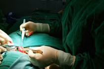 Bổ sung hormon tuyến giáp quá liều nhiều người tai biến