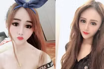 Hình ảnh gây sốc của nữ người mẫu sau phẫu thuật thẩm mỹ