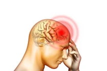 Bí kíp chữa thiểu năng tuần hoàn não