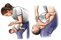 Bé trai hóc đầu bút tử vong, cách sơ cứu trẻ hóc dị vật