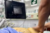 Suy gan nguy kịch do chủ quan với viêm gan B