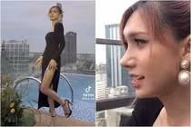 Nhan sắc Lynk Lee hậu sửa mũi gây thất vọng