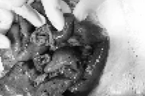 Người đàn ông suýt chết vì... tai nạn bất ngờ khi nằm võng