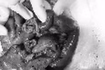 Người đàn ông suýt chết vì... tai nạn bất ngờ khi nằm võng