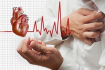 Yếu tố gây tăng huyết áp buổi sáng