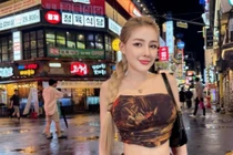 Nhan sắc Ngân 98 gây ngỡ ngàng sau thẩm mỹ