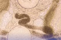 Ăn cá chưa nấu chín, coi chừng nhiễm sán lá ruột nhỏ