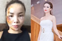 Ca sĩ Yến Trang tái xuất xinh đẹp sau tai nạn