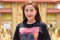 Bị chê gương mặt sưng phù khác lạ, Bảo Thy nói gì?