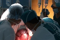 Cận cảnh khối u nặng bằng đứa trẻ 9 tuổi ở TP HCM