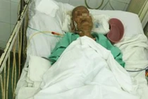 Bà cụ 104 tuổi gãy xương đùi 1 tuần đã đứng được