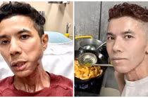 Cuộc sống khó khăn, bệnh tật đau đớn của Kasim Hoàng Vũ ở Mỹ