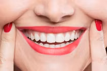 Cao răng - "sát thủ" âm thầm trong… miệng