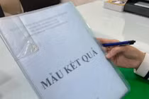 Chồng xét nghiệm ADN cả ba đứa con khi biết vợ ngoại tình