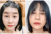 Nhan sắc của Cát Phượng sau gần 1 tháng “dao kéo”