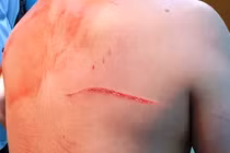 Bắt 4 nghi can truy sát bác sĩ Chiêm Quốc Thái ở TP HCM