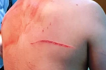 Bắt 4 nghi can truy sát bác sĩ Chiêm Quốc Thái ở TP HCM