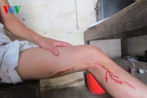 Phóng viên bị lợn rừng tấn công trọng thương