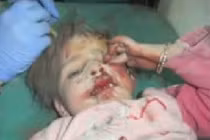 Tàn bạo thai phụ, trẻ em Syria thành "bia đạn sống"