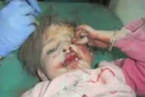 Tàn bạo thai phụ, trẻ em Syria thành "bia đạn sống"