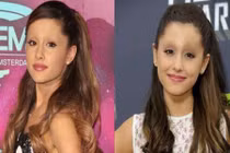 Kinh hoàng hình ảnh sao Hollywood bỗng dưng bị xóa lông mày