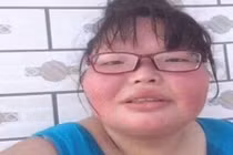 Cô gái xấu xí bất ngờ trở thành hoa khôi đại học