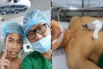 "Thảm họa mạng" Tùng Sơn dao kéo để trông bớt xấu?