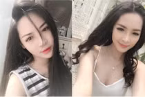 Hot girl Nam Định ước tính "xây lại mặt" hết 1,5 tỷ