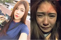 Cô gái Thái bị bạn trai đánh vì không chịu "trao thân"