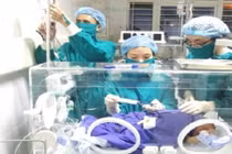 Cứu sống 2 trẻ sơ sinh bị vàng da nhân não sơ sinh