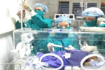 Cứu sống 2 trẻ sơ sinh bị vàng da nhân não sơ sinh