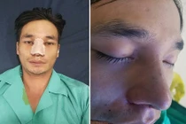 Lệ Rơi phẫu thuật thẩm mỹ để không ai nhận ra mình?