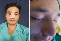 Lệ Rơi phẫu thuật thẩm mỹ để không ai nhận ra mình?