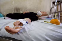 Lỗ hổng trong điều trị ung thư tại Việt Nam