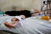 Lỗ hổng trong điều trị ung thư tại Việt Nam