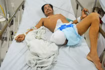 Sống sót kỳ diệu trong rừng sau 6 ngày bị rắn độc cắn