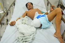 Sống sót kỳ diệu trong rừng sau 6 ngày bị rắn độc cắn