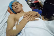 Nam ca sĩ bị chém 11 nhát dao vì tiểu bậy